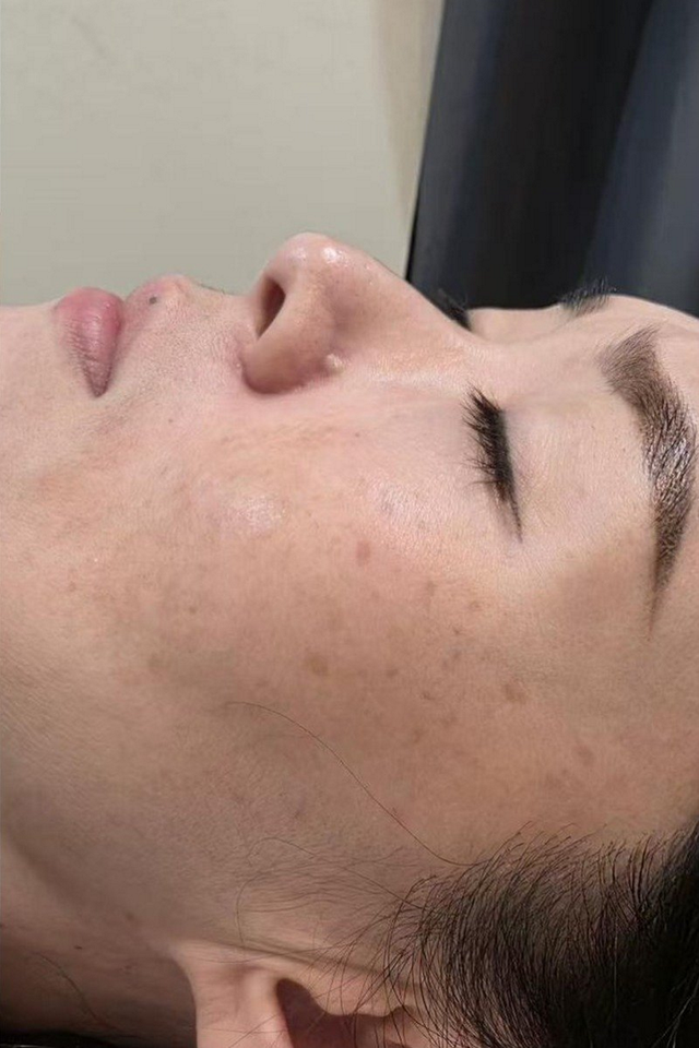 After treatment - Case Study 2