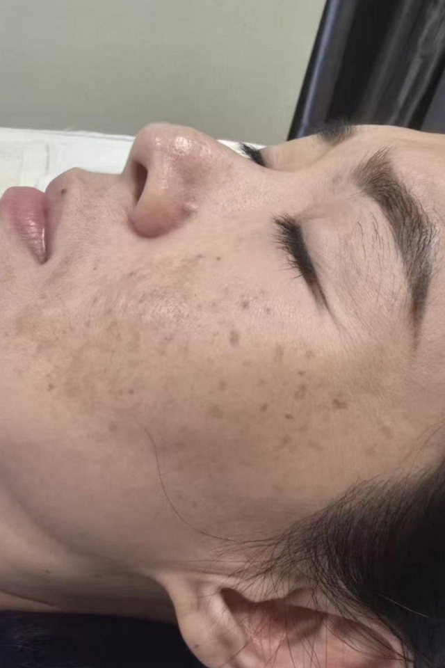 Before treatment - Case Study 2